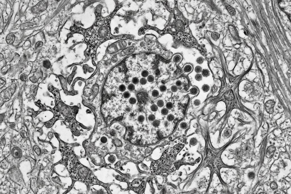 Wenn Lippenherpes das Gehirn erreicht: Was Immunzellen dann tun