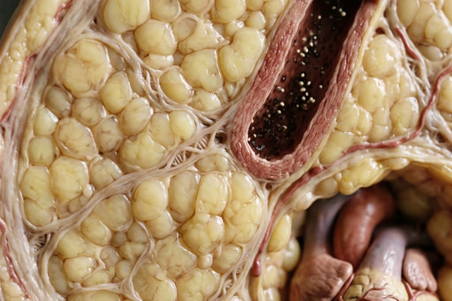 Mehr als eine Zahl: Was Gene über die Gesundheitsrisiken von Übergewicht verraten
